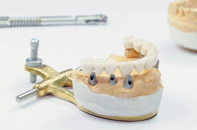 цены на протезирование зубов алматы цены на протезирование зубов алматы